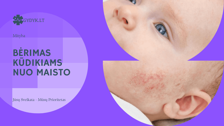 Bėrimas kūdikiams nuo maisto: kaip atskirti alergiją nuo įprasto dirginimo Bėrimas kūdikiams nuo maisto: kaip atskirti alergiją nuo įprasto dirginimo