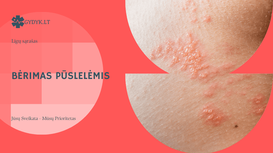 Bėrimas pūslelėmis: priežastys ir ligos, kurios jį sukelia