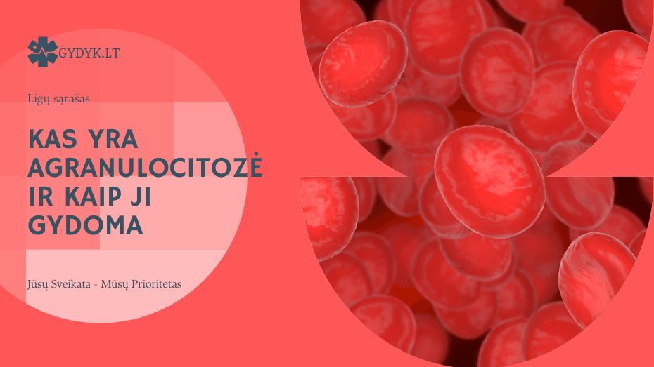 Kas yra agranulocitozė ir kaip ji gydoma: pavojai ir diagnostika