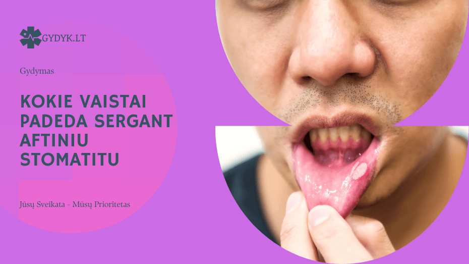 Kokie vaistai padeda sergant aftiniu stomatitu: gydymo pasirinkimai Kokie vaistai padeda sergant aftiniu stomatitu: gydymo pasirinkimai
