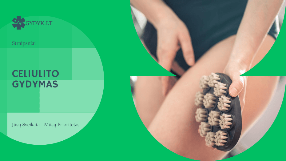 Celiulito gydymas: kas iš tikrųjų veikia?