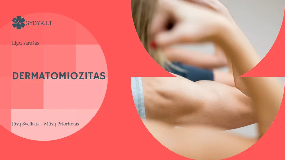 Dermatomiozitas: kas tai, kokie simptomai ir kokios galimos pasekmės