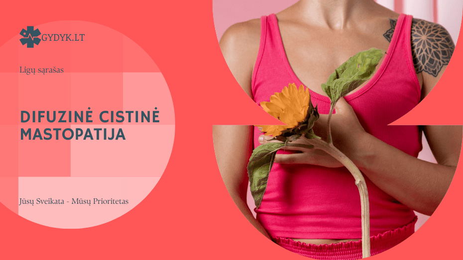 Difuzinė cistinė mastopatija: kas tai, simptomai ir kada reikia sunerimti
