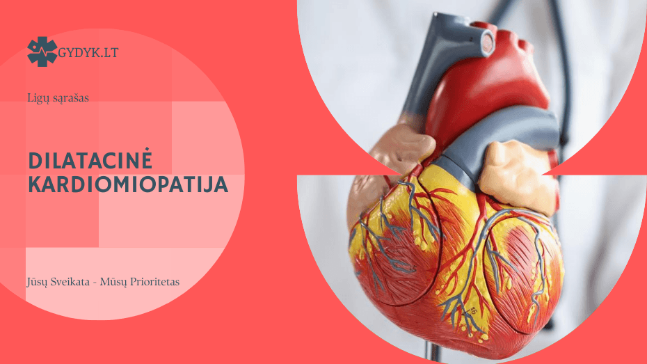 Dilatacinė kardiomiopatija: kas tai, simptomai ir gydymo galimybės