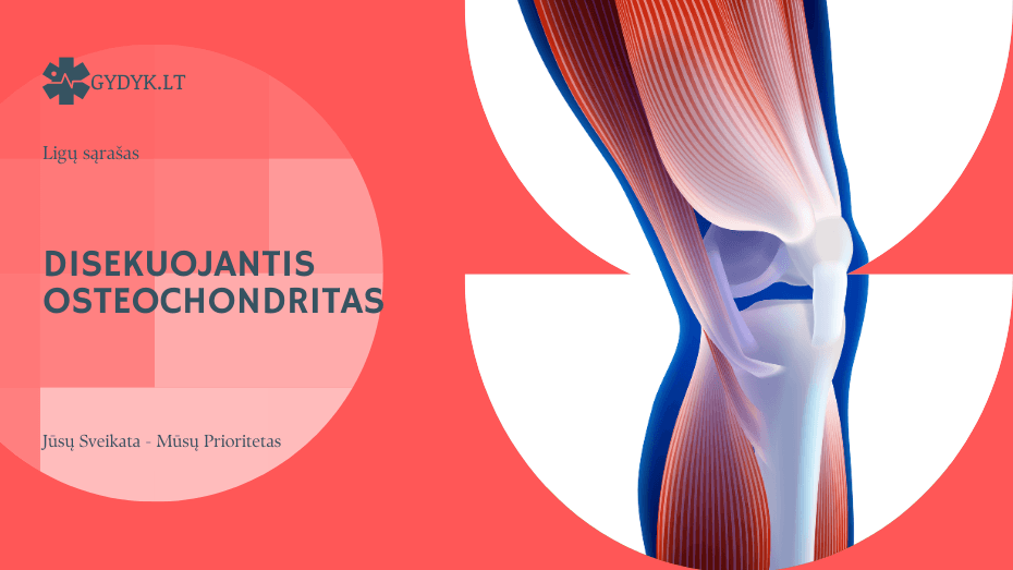 Disekuojantis osteochondritas: priežastys, simptomai ir gydymas Disekuojantis osteochondritas: priežastys, simptomai ir gydymas
