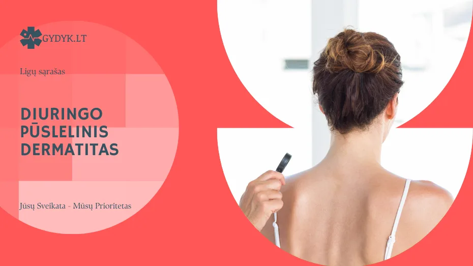 Diuringo pūslelinis dermatitas: priežastys, simptomai ir gydymas