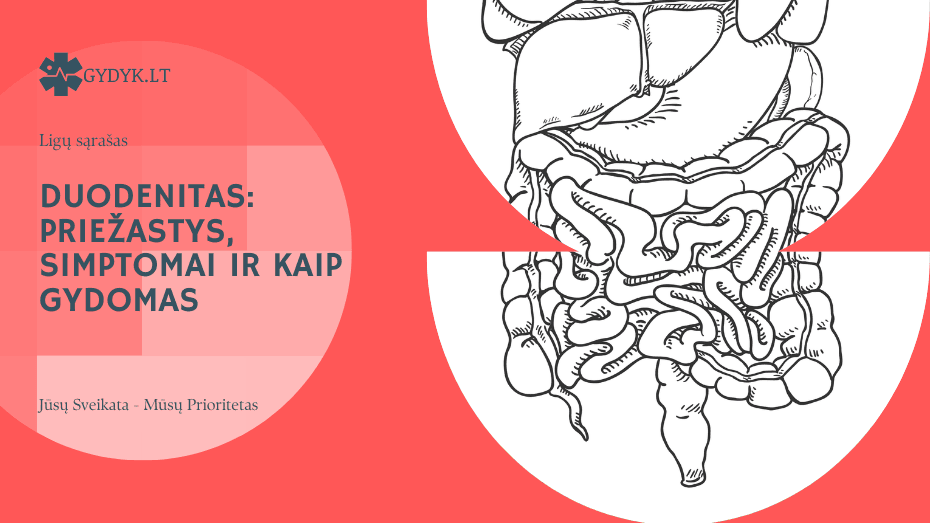 Duodenitas: priežastys, simptomai ir kaip gydomas Duodenitas: priežastys, simptomai ir kaip gydomas