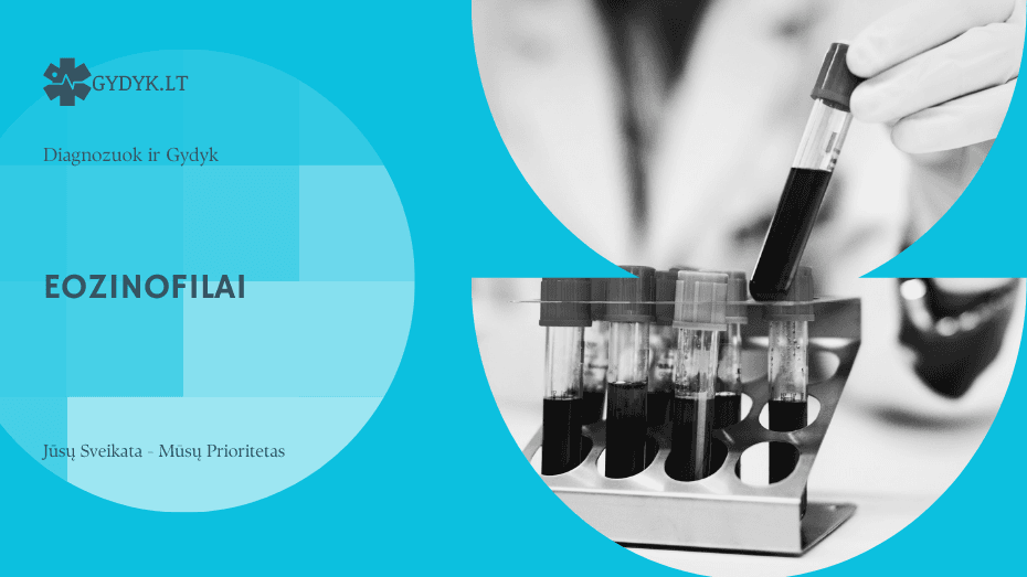 Eozinofilai: kas tai, norma ir ką reiškia padidėjimas ar sumažėjimas