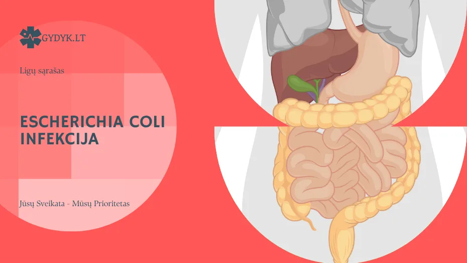 Escherichia coli infekcija: priežastys, simptomai ir gydymas