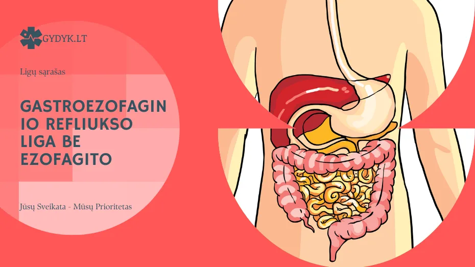 Gastroezofaginio refliukso liga be ezofagito: kas tai, simptomai ir gydymas