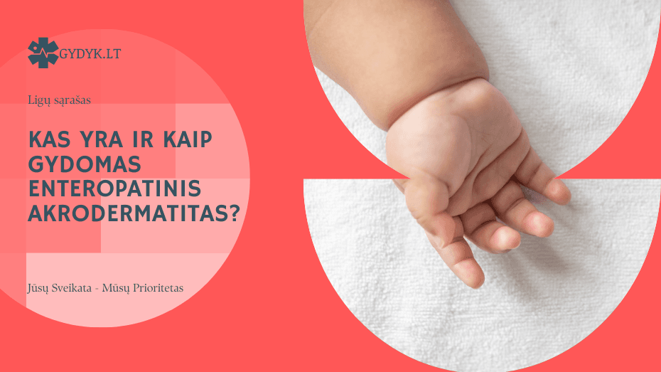 Kas yra ir kaip gydomas enteropatinis akrodermatitas?