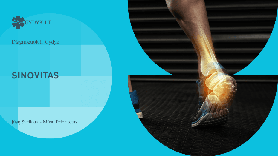 Sinovitas: požymiai, priežastys ir gydymo būdai