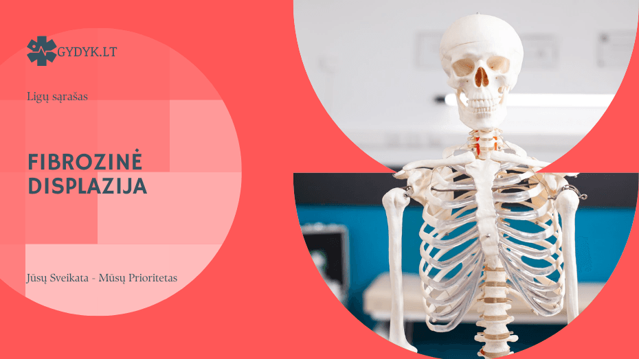 Fibrozinė displazija – kaulų vystymosi sutrikimas