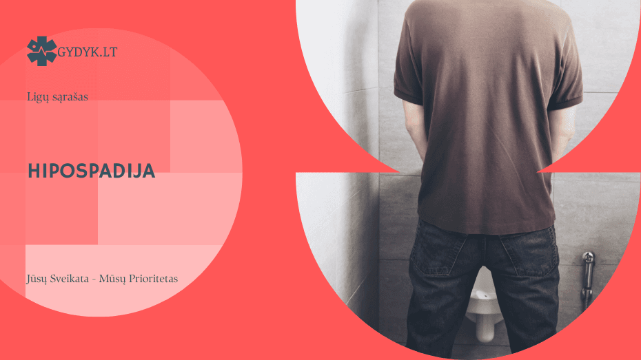 Hipospadija: priežastys, formos ir chirurginio gydymo galimybės