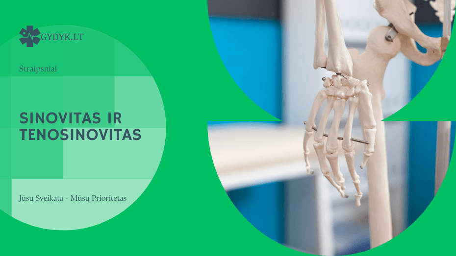 Sinovitas ir tenosinovitas