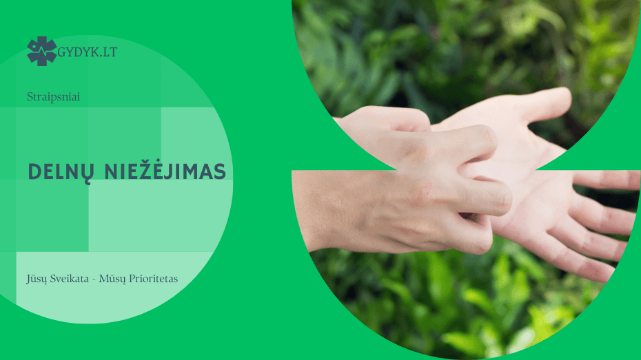 Delnų niežėjimas: priežastys ir liaudiški prietarai