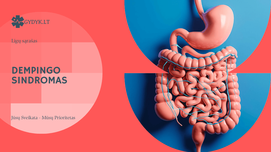 Dempingo sindromas: simptomai, priežastys ir kaip palengvinti būklę