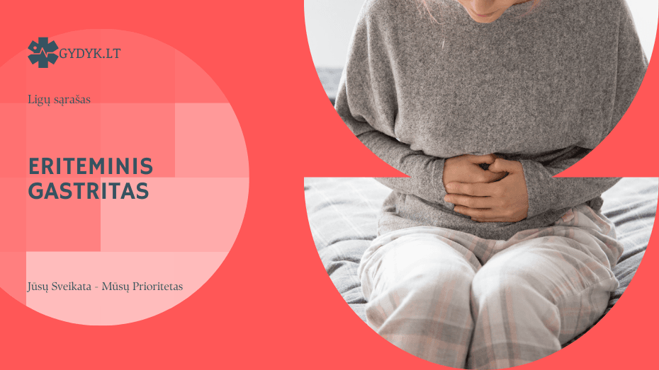 Eriteminis gastritas – kas tai yra, ar tai pavojinga ir kaip gydomas