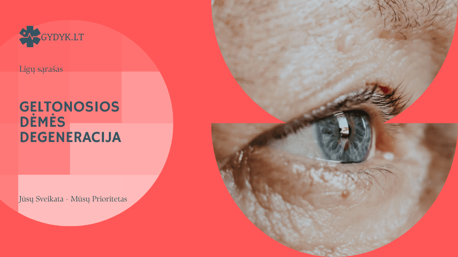Geltonosios dėmės degeneracija: simptomai, gydymas ir kaip sustabdyti regėjimo blogėjimą