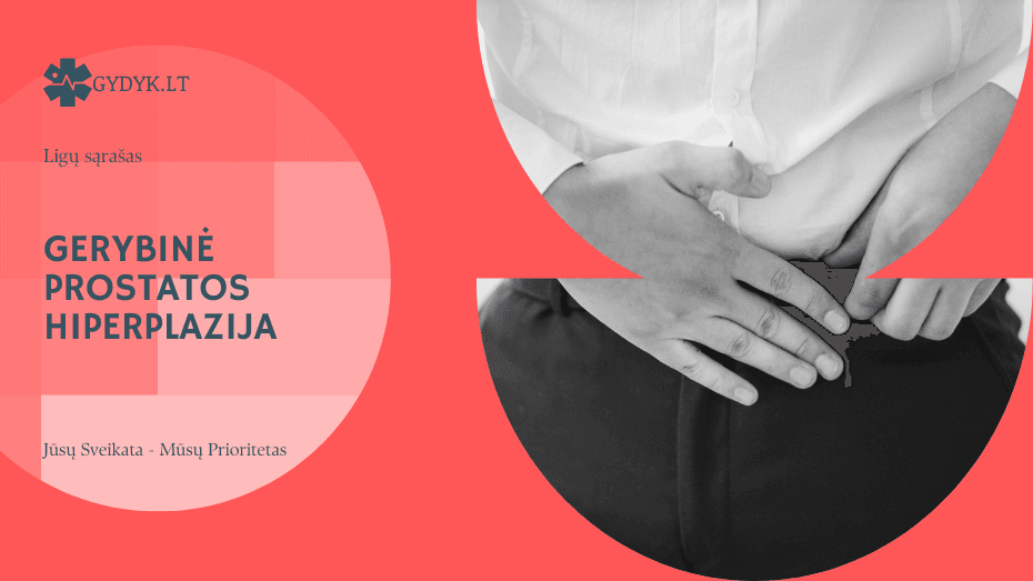 Gerybinė prostatos hiperplazija – simptomai, kurių negalima ignoruoti