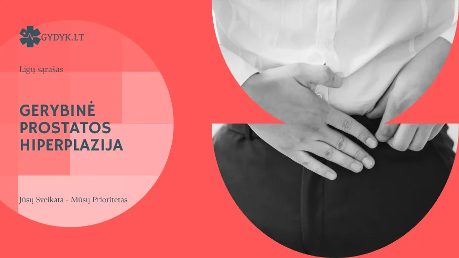 Gerybinė prostatos hiperplazija – simptomai, kurių negalima ignoruoti Gerybinė prostatos hiperplazija – simptomai, kurių negalima ignoruoti