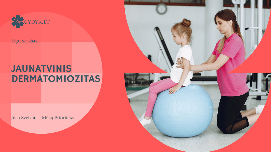 Jaunatvinis dermatomiozitas: simptomai, priežastys ir gydymas vaikams