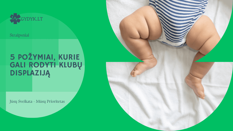 5 požymiai, kurie gali rodyti klubų displaziją