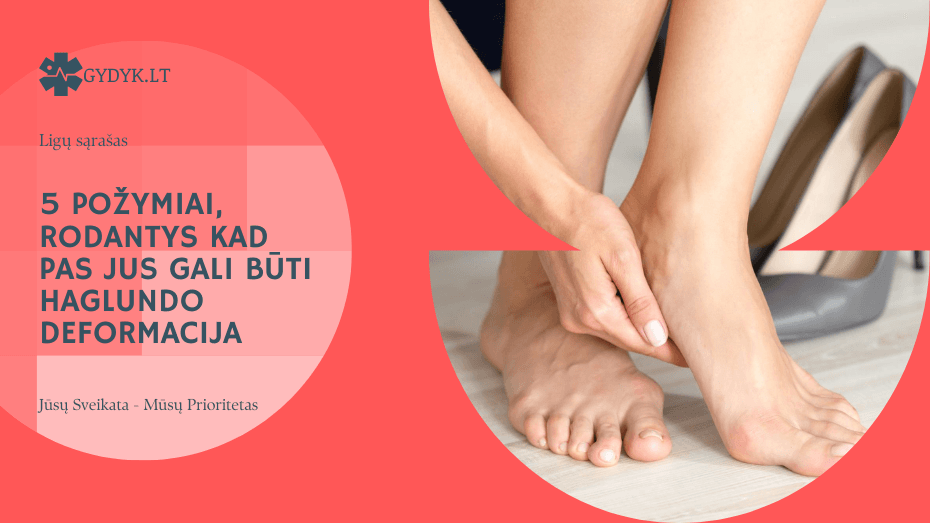 5 požymiai, rodantys, kad pas jus gali būti Haglundo deformacija