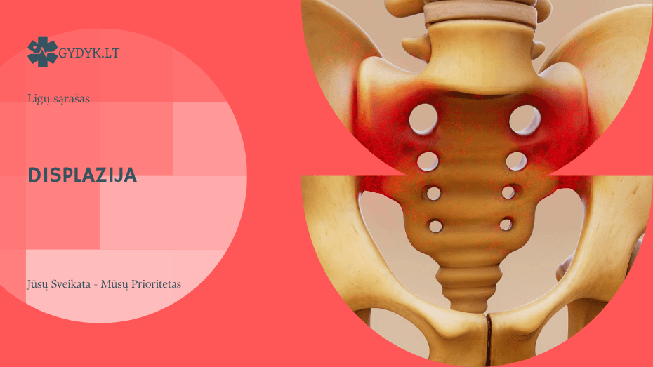 Displazija: kas tai yra, priežastys, diagnostika ir gydymo galimybės