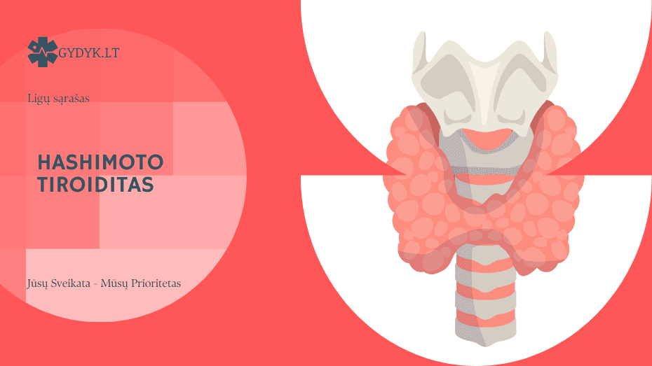 Hashimoto tiroiditas