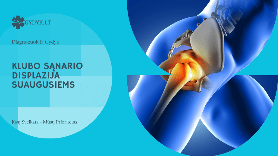 Klubo sąnario displazija suaugusiems: simptomai ir gydymo galimybės