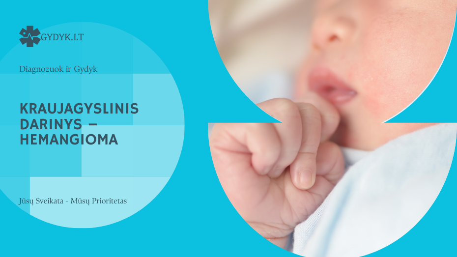 Kraujagyslinis darinys – hemangioma