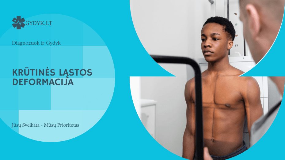 Krūtinės ląstos deformacija: gydymo būdai ir kada reikalinga operacija