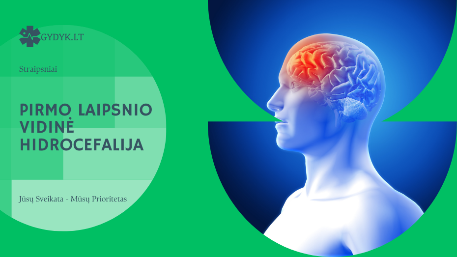 Pirmo laipsnio vidinė hidrocefalija: ką reiškia ši diagnozė?