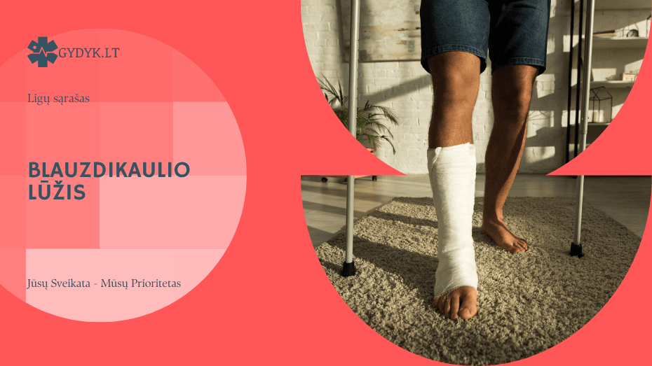 Blauzdikaulio lūžis: kiek trunka reabilitacija ir grįžimas į įprastą gyvenimą