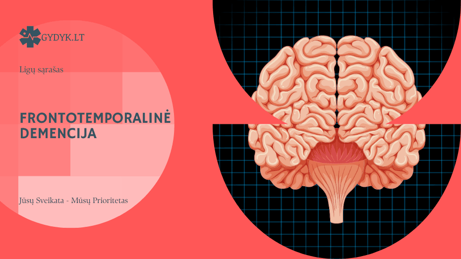 Frontotemporalinė demencija: kas tai yra ir kokie pagrindiniai simptomai?