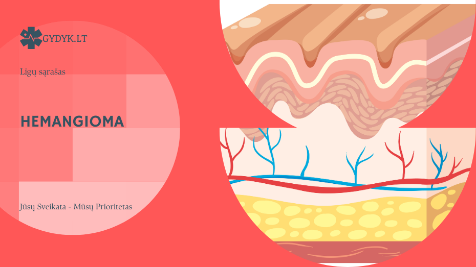 Hemangioma: tipai, klinikinė eiga ir gydymo galimybės