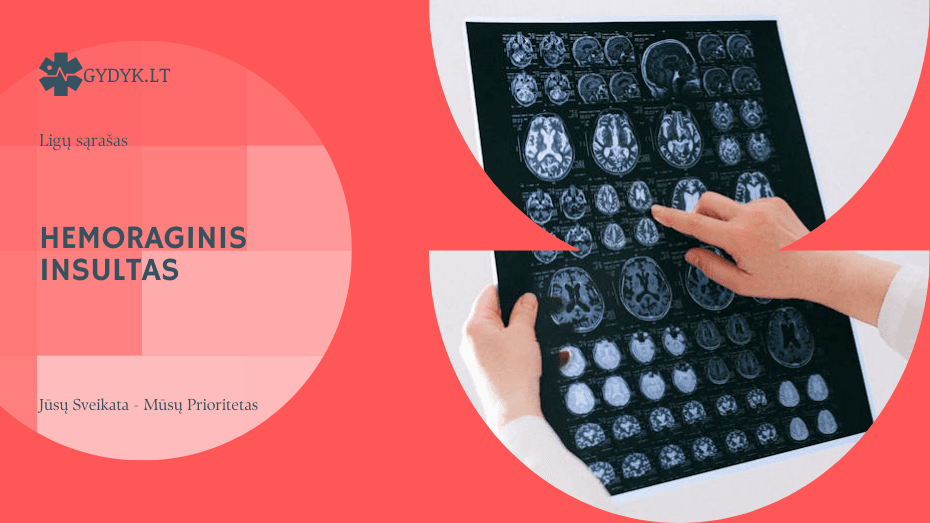 Hemoraginis insultas: priežastys, simptomai, gydymas ir pasekmės