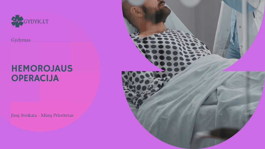 Hemorojaus operacija: kada ji reikalinga ir kaip atliekama