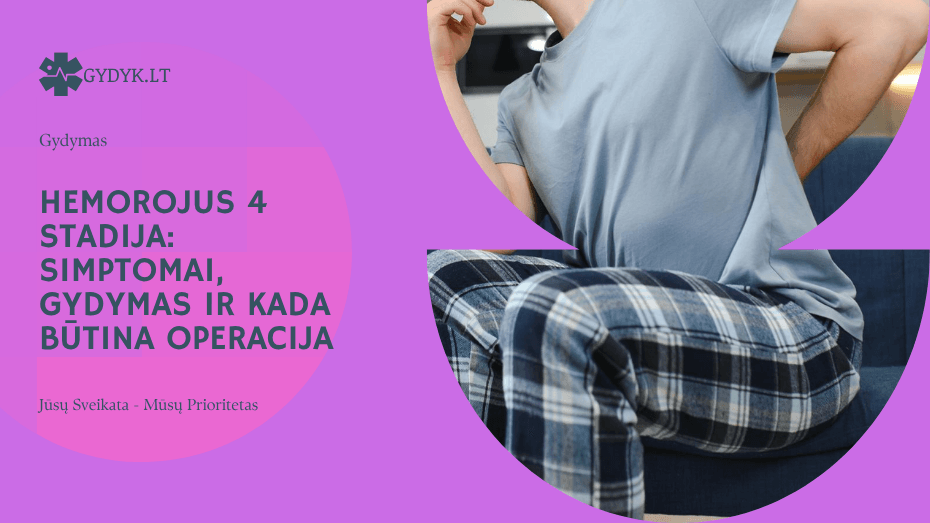 Hemorojus 4 stadija: simptomai, gydymas ir kada būtina operacija
