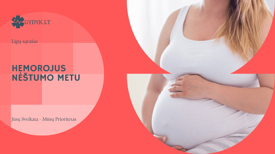 Hemorojus nėštumo metu: kodėl atsiranda ir kaip saugiai jį gydyti