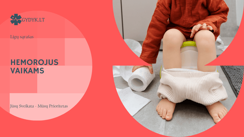 Hemorojus vaikams: simptomai, gydymas ir kada kreiptis į gydytoją