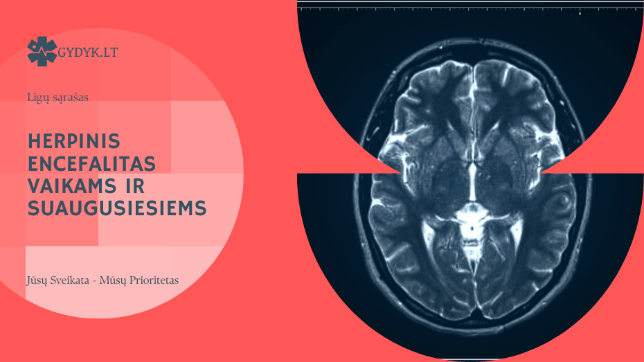 Herpinis encefalitas vaikams ir suaugusiesiems: eiga, rizikos veiksniai ir pasekmės