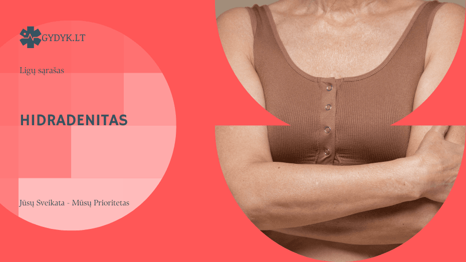 Hidradenitas: kas tai yra ir kokie pagrindiniai simptomai