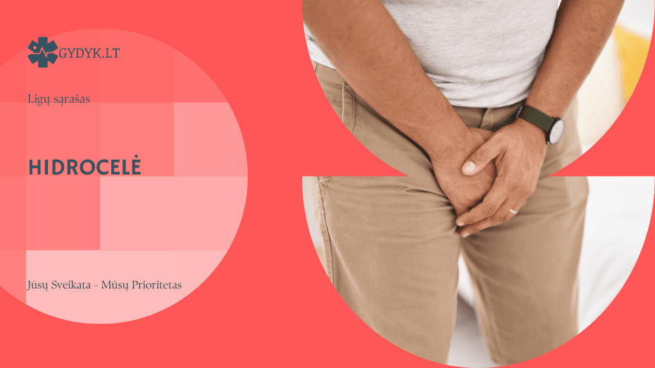 Hidrocelė: kas tai yra ir kokie pagrindiniai simptomai