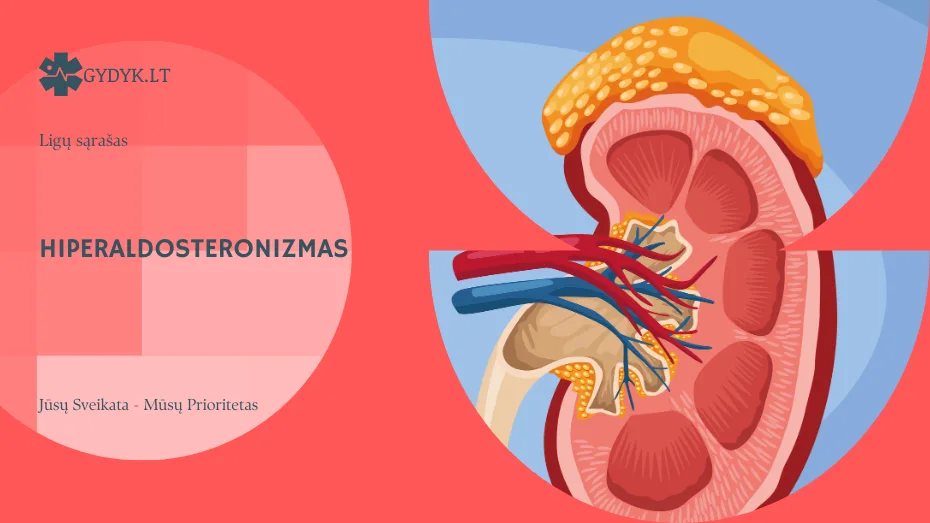 Hiperaldosteronizmas: priežastys, diagnostika ir gydymo galimybės
