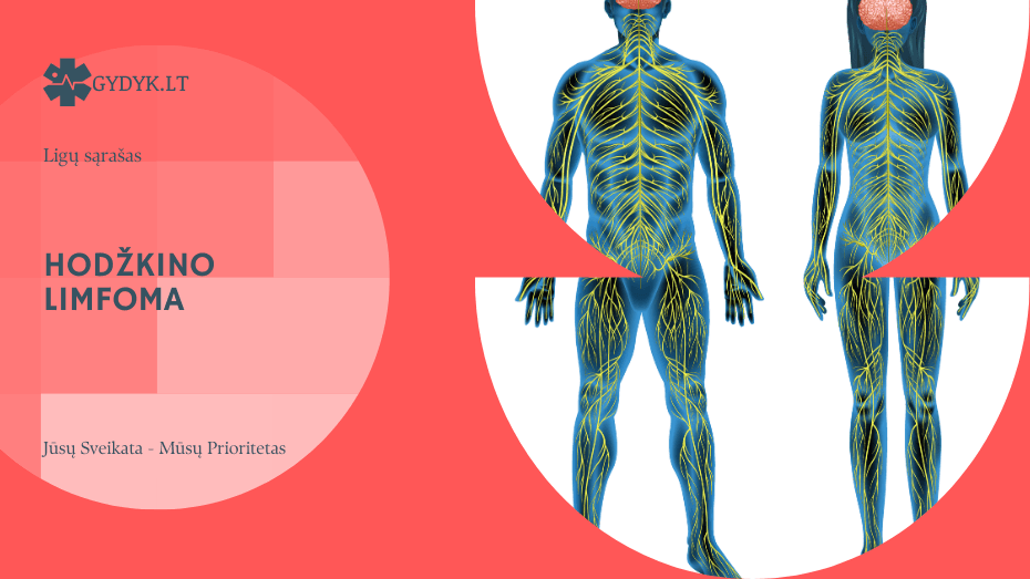 Hodžkino limfoma: koks yra išgyvenamumas skirtingose ligos stadijose