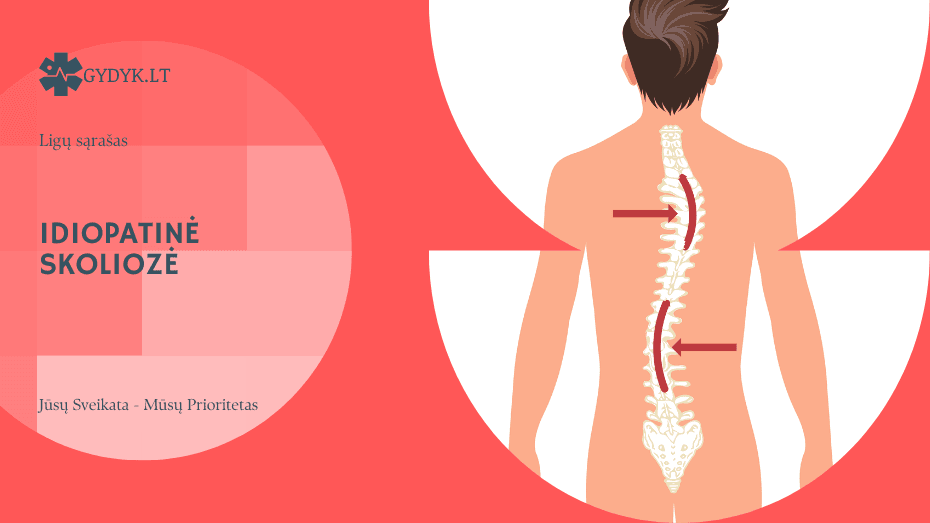 Idiopatinė skoliozė: kas tai yra ir kodėl ji atsiranda