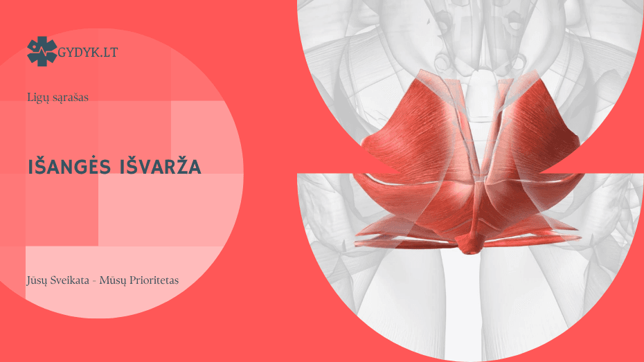 Išangės išvarža: priežastys, simptomai ir gydymo galimybės