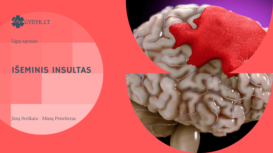 Išeminis insultas: simptomai, priežastys ir kaip atpažinti laiku